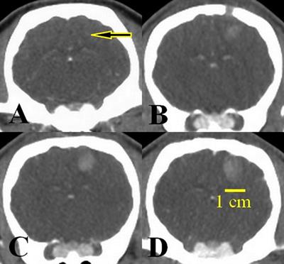 Therapeutic efficacy of 166Holmium siloxane in microbrachytherapy of induced glioblastoma in minipig tumor model